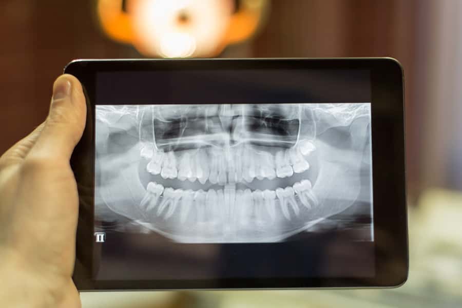 Professional Center of Dental Care uses the newest dental technology in Bolingbrook, IL to enhance the health and wellness of their patients. Dr. Russell Bak and Dr. Debra Alavi, recommended general dentists in 60440, are committed to your dental health in Bolingbrook, IL. quality dental care in Bolingbrook IL